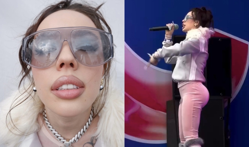 Новости шоу-бизнеса: ягодицы у Хайдарова только ради хайпа: «Ввязалась в эту авантюру»