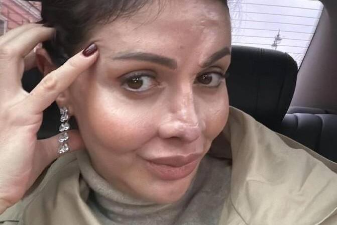 Новости шоу-бизнеса: бывшей жене Аршавина восстановили утраченный нос. Опубликованы шокирующие кадры после операции — БлокнотРУ — Аршавин новости. Аршавин последние новости. Аршавин новости сегодня. Андрей Аршавин новости. Андрей Аршавин последние новости. Андрей Аршавин новости сегодня. Новости шоу бизнеса. Новости шоу-бизнеса России сегодня. Новости шоу-бизнеса. Новости шоу-бизнеса России. Новости шоу бизнеса России сегодня. Последние новости шоу бизнеса России. Шоу бизнес России сегодня. Шоу бизнес на 15.10.2025.